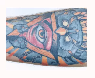 Détatouage tatouage en couleurs