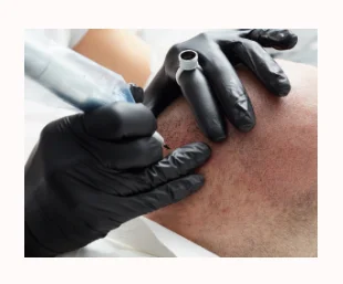 Tatouage médical