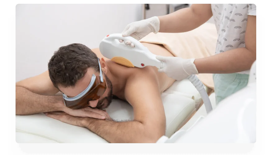 epilation-au-laser Épilation au laser - Digidream